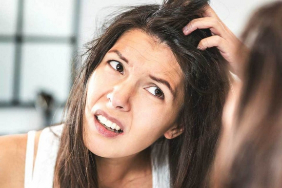 dandruff remedies in home