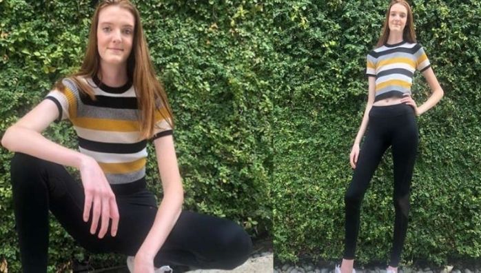 Texan teen breaks Guinness World Record for longest legs