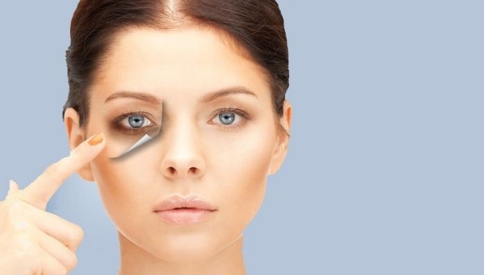 Tips to reduce dark circles on eyes