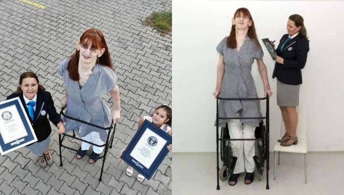 Rumeysa Gelgi, the tallest woman in the world